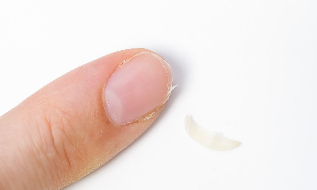 Därför skadas dina naglar – och hur du kan skydda dem