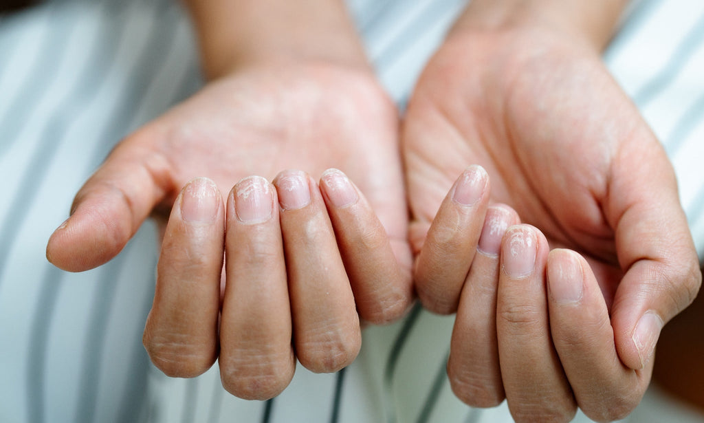 Sköra och skadade naglar? Så stärker du dem igen!